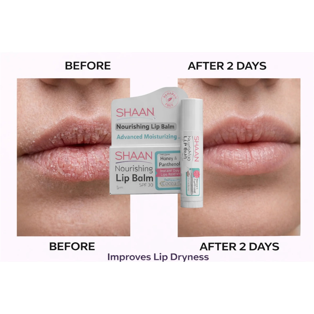 Shaan Lip Balm 5 gm