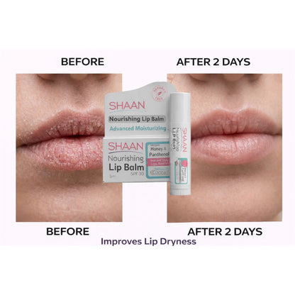 Shaan Lip Balm 5 gm